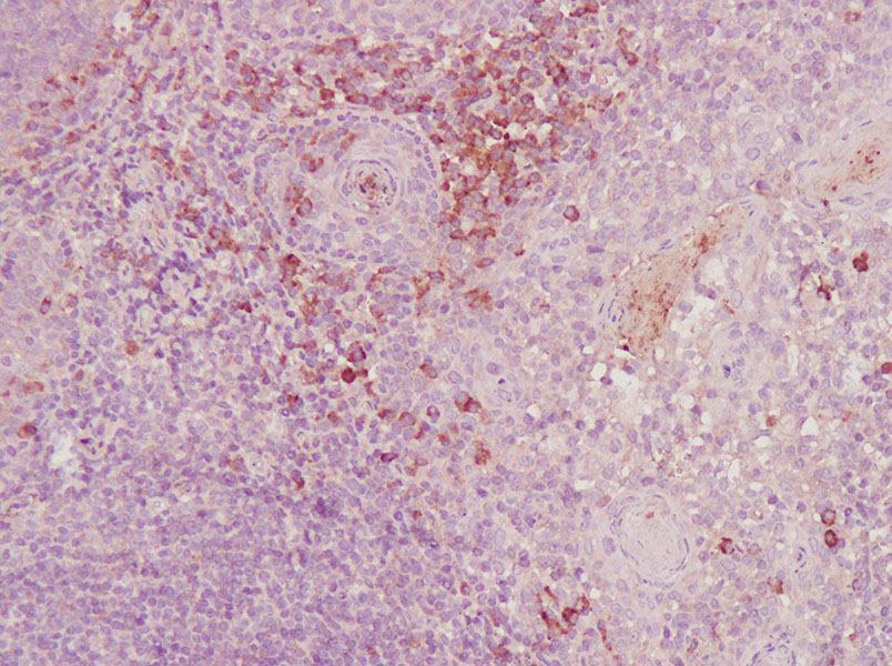 AF/LE Purified Anti-Human CD3 Antibody[OKT-3]-产品推荐-3