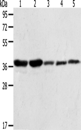 Western Blot analysis of A431, NIH/3T3, Hela, Jurkat and PC3 cell using ANXA1 Polyclonal Antibody at dilution of 1:400