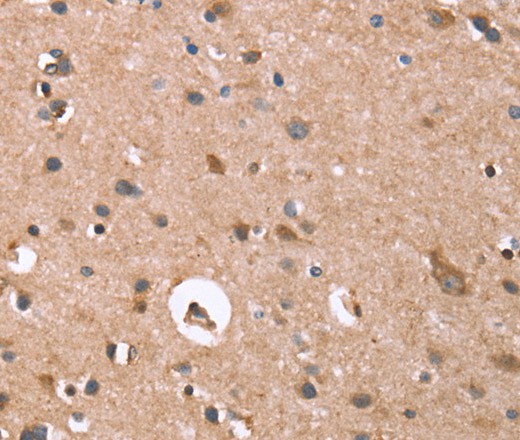 Immunohistochemistry of paraffin-embedded Human brain  tissue using GPC6 Polyclonal Antibody at dilution 1:40