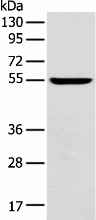 Western blot analysis of Mouse brain tissue  using FOXG1  Polyclonal Antibody at dilution of 1:550