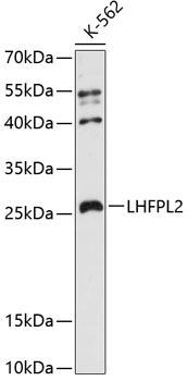 Western blot analysis of extracts of K-562 cells using LHFPL2 Polyclonal Antibody at 1:3000 dilution.