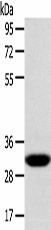 Western Blot analysis of Human fetal liver tissue using CCS Polyclonal Antibody at dilution of 1:300