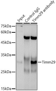 Immunoprecipitation analysis of 300ug extracts of A-549 cells using 3ug Timm29 Polyclonal Antibody.Western blot was performed from the immunoprecipitate using Timm29 Polyclonal Antibody at a dilution of 1:1000.