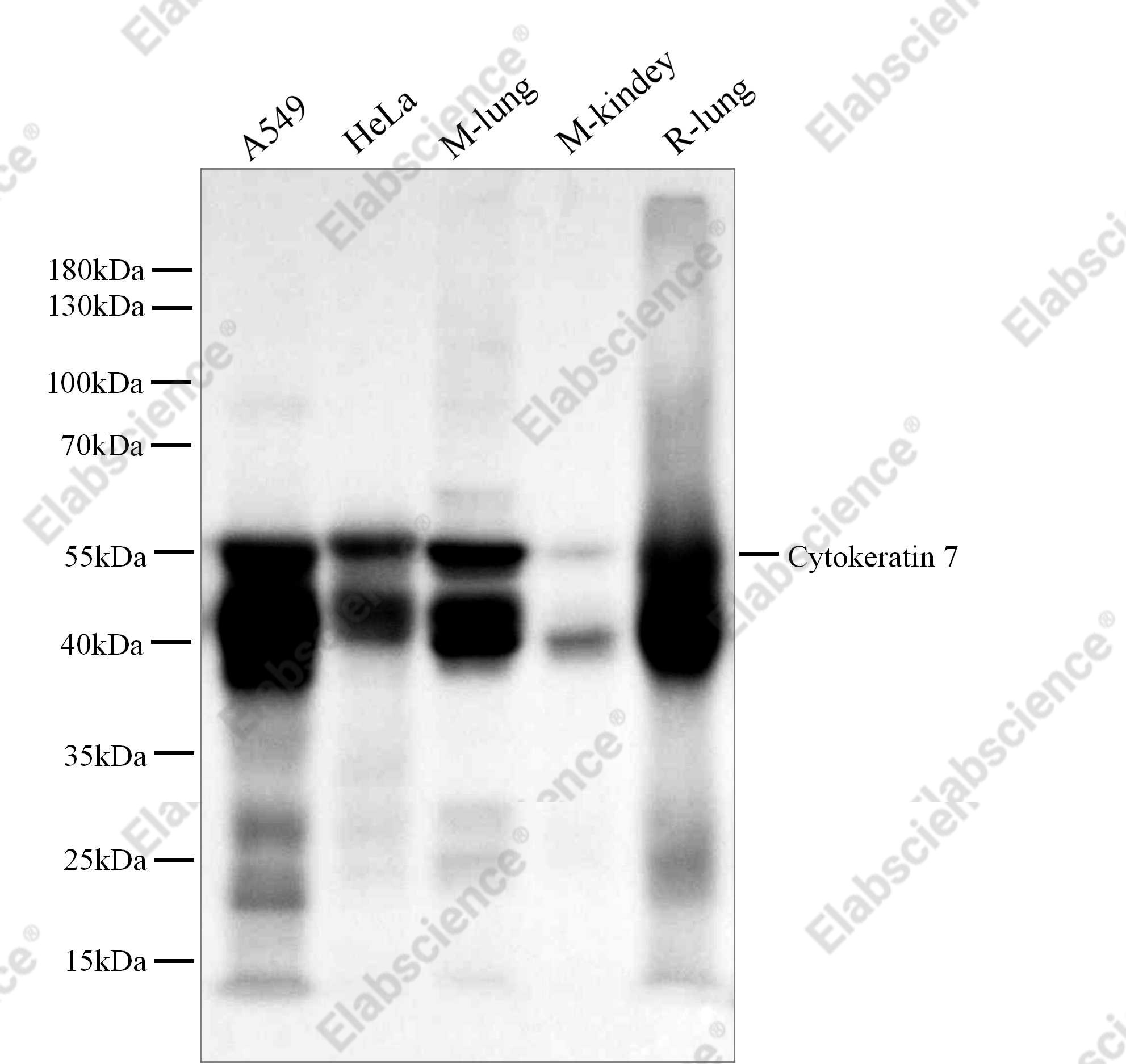 Recombinant Cytokeratin 7/KRT7 Monoclonal Antibody - 4