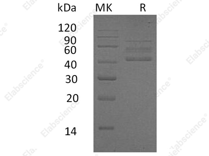 Recombinant Human RELT/TNFRSF19L Protein (Fc Tag) - 1