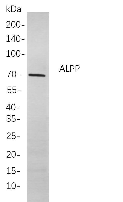 Recombinant ALPP Monoclonal Antibody-searchlist-1