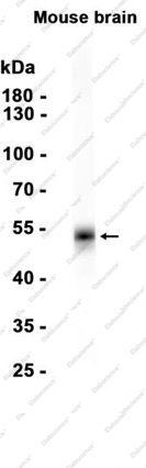 Recombinant AP2M1 Monoclonal Antibody - 1