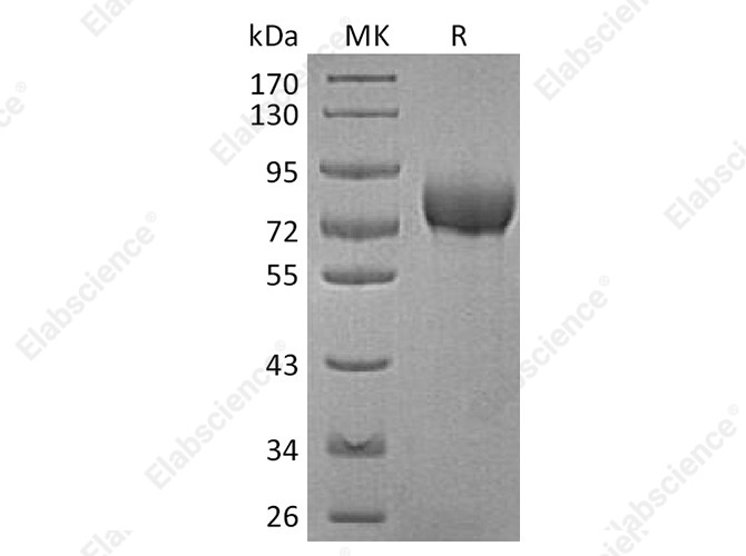 Recombinant Human BCAM Protein (His Tag) - 1
