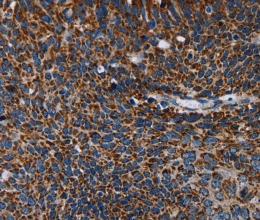 IDH2 Polyclonal Antibody - 2