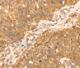 ERK 5 Polyclonal Antibody - 2