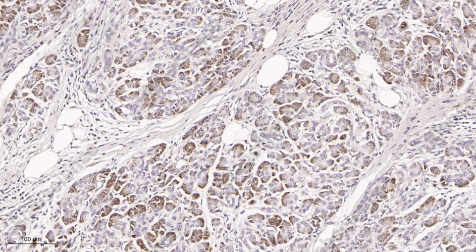 Recombinant Phospho-FOXO3A (Ser253) Monoclonal Antibody - 2
