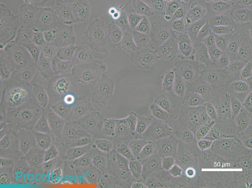 NIH:OVCAR-3 [OVCAR3] - 6