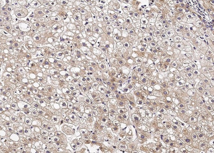 Recombinant VAPB/VAP-B Monoclonal Antibody - small - 3