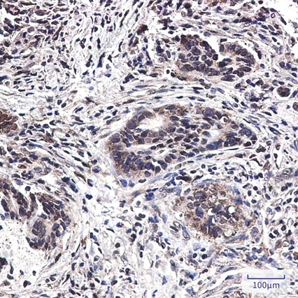 Recombinant MST1 Monoclonal Antibody - 3