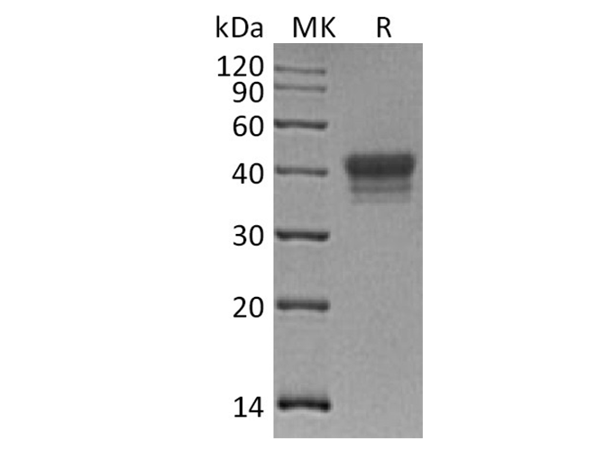 Recombinant Human EphB1/EPHT2 Protein (aa 564-984, His Tag)(Active)