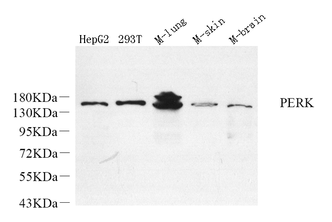 Western Blot analysis of various samples using PERK Polyclonal Antibody at dilution of 1:800.