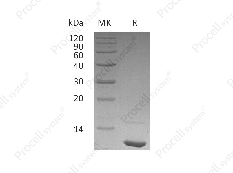 IGF-I/IGF1/MGF, Human, Recombinant