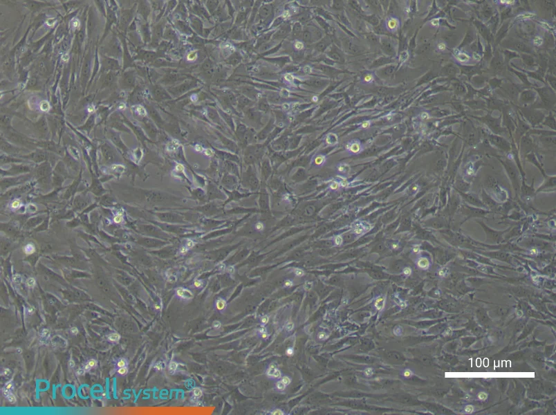 Mouse Periodontal Ligament Fibroblasts - 1