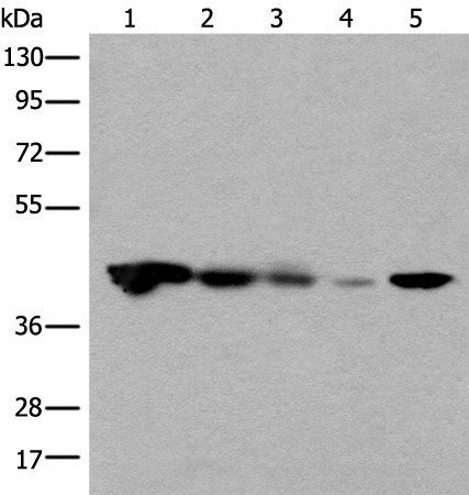 Western blot analysis of Jurkat HEPG2 and Hela cell Human testis tissue 231 cell lysates  using CECR5 Polyclonal Antibody at dilution of 1:650