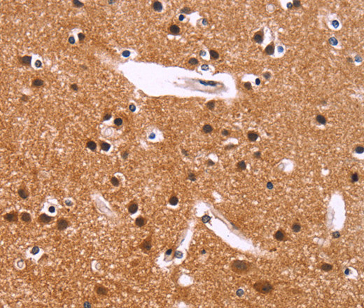 Immunohistochemistry of paraffin-embedded Human brain using IRAK1BP1 Polyclonal Antibody at dilution of 1:40