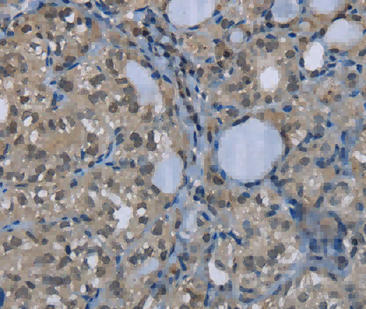 GYS1 Polyclonal Antibody - 3