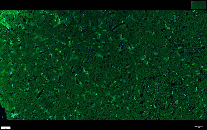 Recombinant LC3B Monoclonal Antibody - small - 8