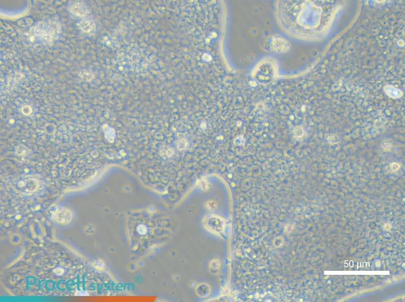 NCI-N87 [N87] - 6