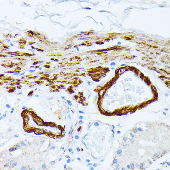 Immunohistochemistry of paraffin-embedded Human stomach using TPM2 Polyclonal Antibody at dilution of 1:100 (40x lens).