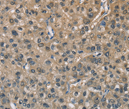 ENO1 Polyclonal Antibody - 2