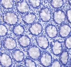 Recombinant Gastric Mucin-6/MUC6 Monoclonal Antibody - small - 2