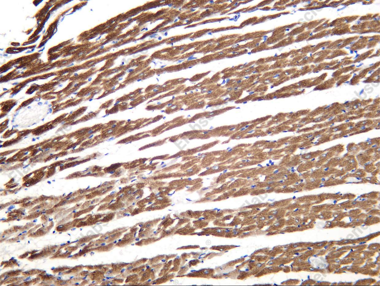 Recombinant MYL3 Monoclonal Antibody - 4