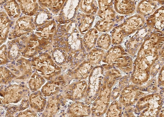 Recombinant Biotinidase/biotinase/BTD Monoclonal Antibody - small - 2