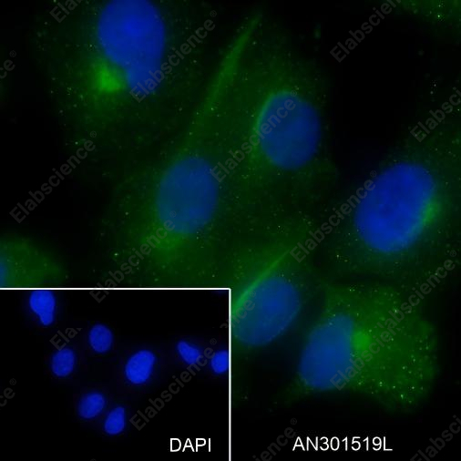Recombinant Factor XIIIa Monoclonal Antibody - 6
