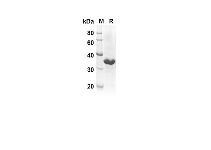 Recombinant Rat IL-21 Protein(Trx Tag)-1