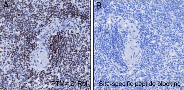 Recombinant Histone H4 (Acetyl Lys12) Monoclonal Antibody-searchlist-4