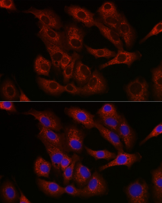 Immunofluorescence analysis of A-549 cells using Bcl-2 Polyclonal Antibody at dilution of 1:200. Blue: DAPI for nuclear staining.