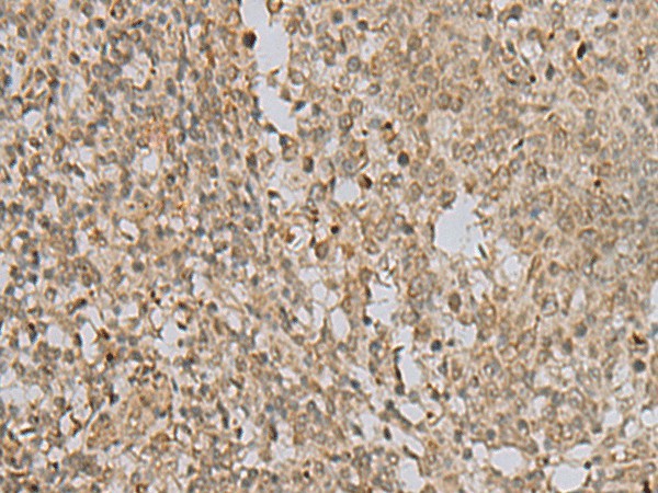 Immunohistochemistry of paraffin-embedded Human tonsil tissue  using LYRM1 Polyclonal Antibody at dilution of 1:40(?200)