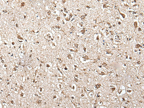 Immunohistochemistry of paraffin-embedded Human brain tissue  using ZFP36 Polyclonal Antibody at dilution of 1:55(?200)