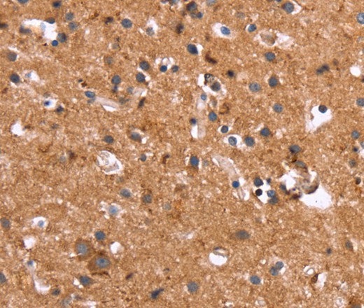 Immunohistochemistry of paraffin-embedded Human brain using HSD17B1 Polyclonal Antibody at dilution of 1:40