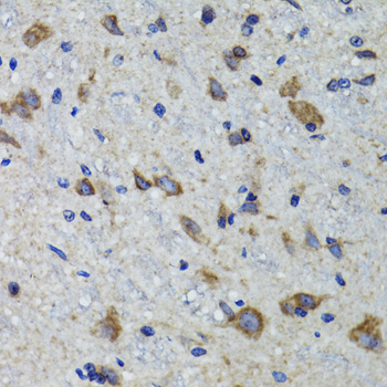 Immunohistochemistry of paraffin-embedded Mouse spinal cord using HEXA Polyclonal Antibody at dilution of 1:100 (40x lens).