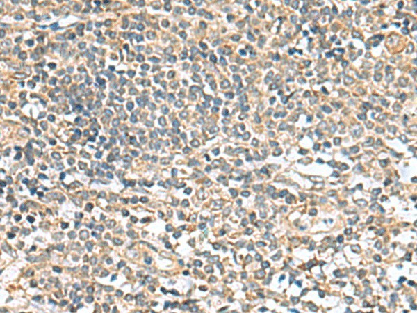 Immunohistochemistry of paraffin-embedded Human tonsil tissue  using CCDC134 Polyclonal Antibody at dilution of 1:50(?200)