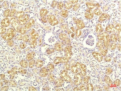 Immunohistochemistry of paraffin-embedded Human kidney tissue using IL8 Monoclonal Antibody at dilution of 1:200.