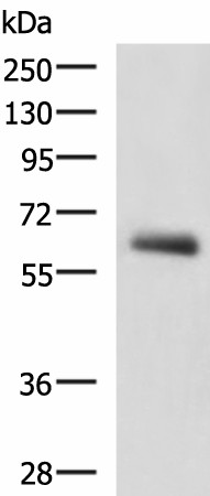 Western blot analysis of Human metastatic papillary carcinoma(thyroid cancer) tissue lysate  using KBTBD11 Polyclonal Antibody at dilution of 1:2300