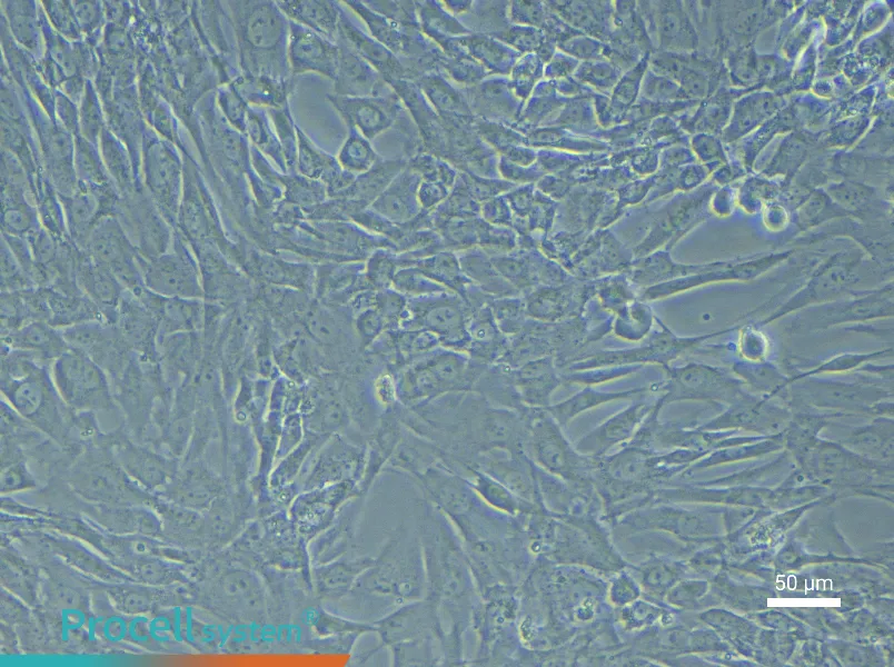 Human Uterine Fibroblast Complete Medium - 4