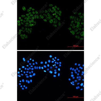 Recombinant Casein Kinase 2 beta Monoclonal Antibody - 4