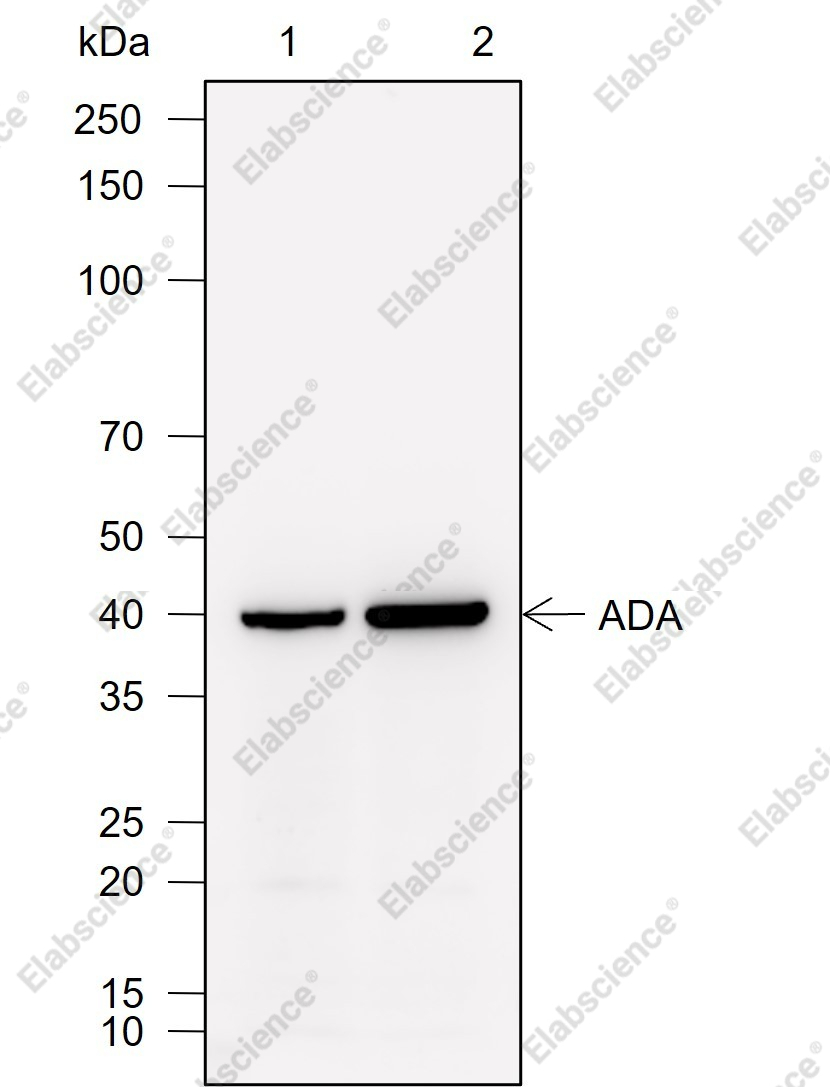 Recombinant ADA Monoclonal Antibody - 1
