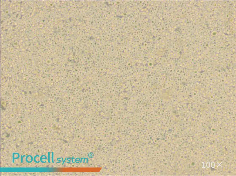 U266 [U266B1] Cell Complete Medium - 2