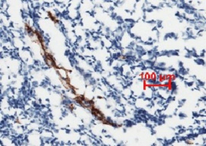 Recombinant vWF Monoclonal Antibody - small - 1