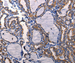 DRD1 Polyclonal Antibody - 2