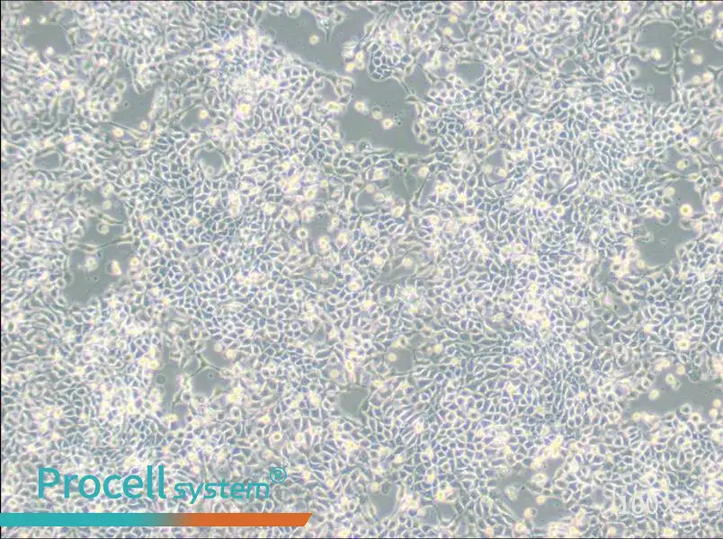 RT-112 Cell Complete Medium - 1